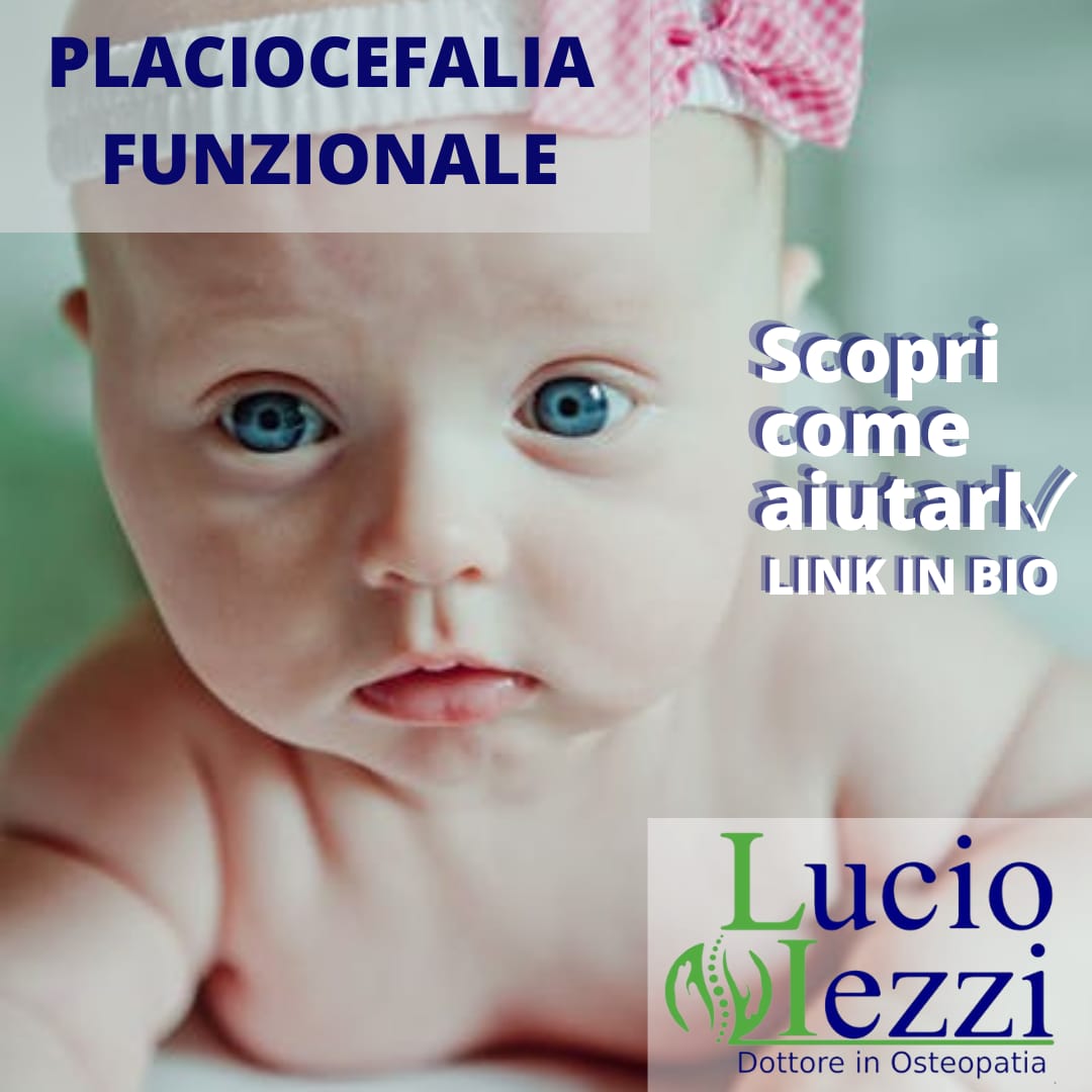 Osteopatia pediatrica, neonato, plagiocefalia, neonato, osteopata per bambini. Chieti, Pescara, Abruzzo